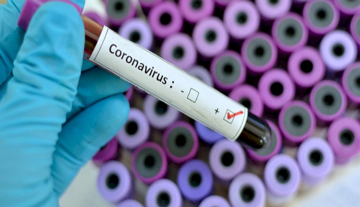 Rusya ve Türkiye’den korona virüs aşısı için ortak çalışma kararı